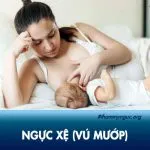 Ngực xệ là như thế nào? Chỉ rõ nguyên nhân khiến vú xệ và cách khắc phục