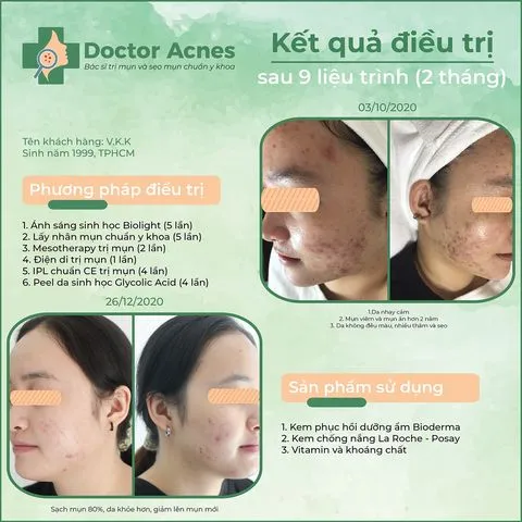 Trị mụn tphcm phòng khám Doctor Acnes 