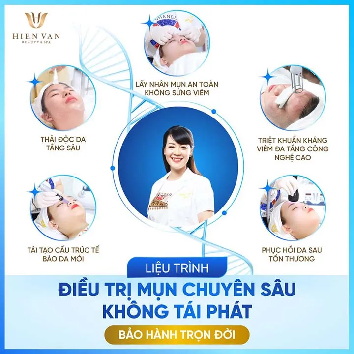 Hiền vân spa trị mụn uy tín tại TP HCM